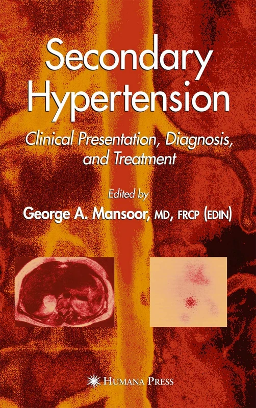 Secondary Hypertension - Clinical Presentation and Diagnosis