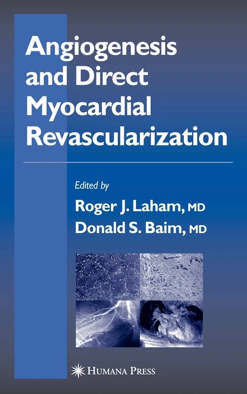 Angiogenesis and Direct Myocardial Revascularization (Contemporary Cardiology)