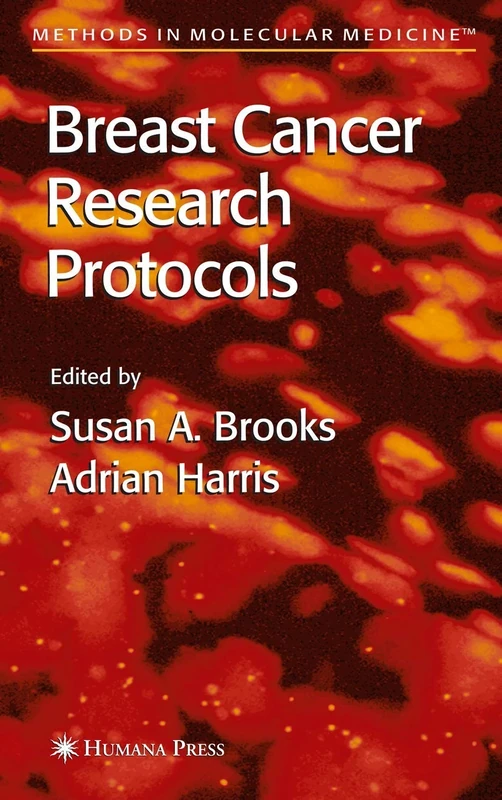 Breast Cancer Research Protocols: 120 (Methods in Molecular Medicine, 120)