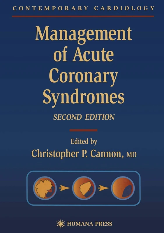 Management of Acute Coronary Syndromes (Contemporary Cardiology)