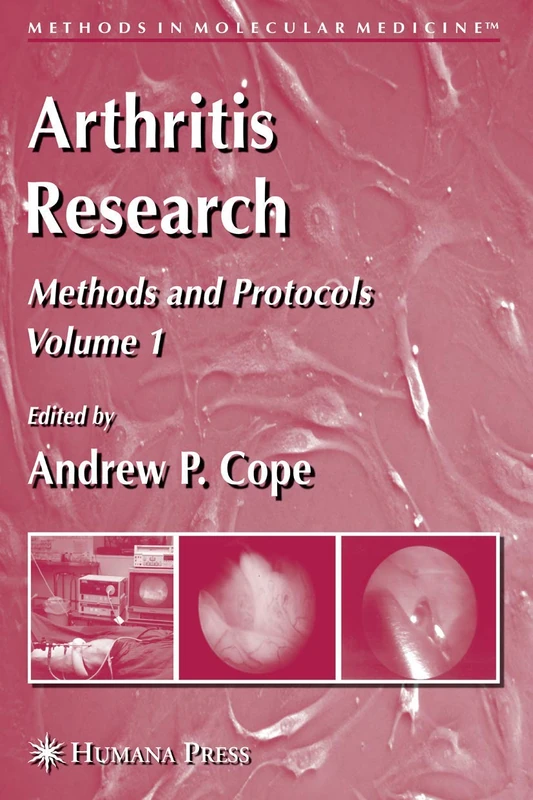 Arthritis Research: Volume 1: Methods and Protocols: 135 (Methods in Molecular Medicine, 135)