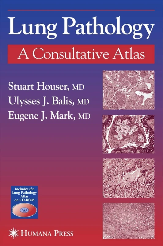 Lung Pathology: A Consultative Atlas (Current Clinical Pathology)