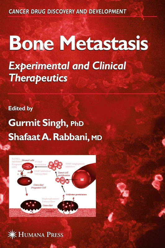 Humana Bone Metastasis - Cancer Drug Discovery and Development