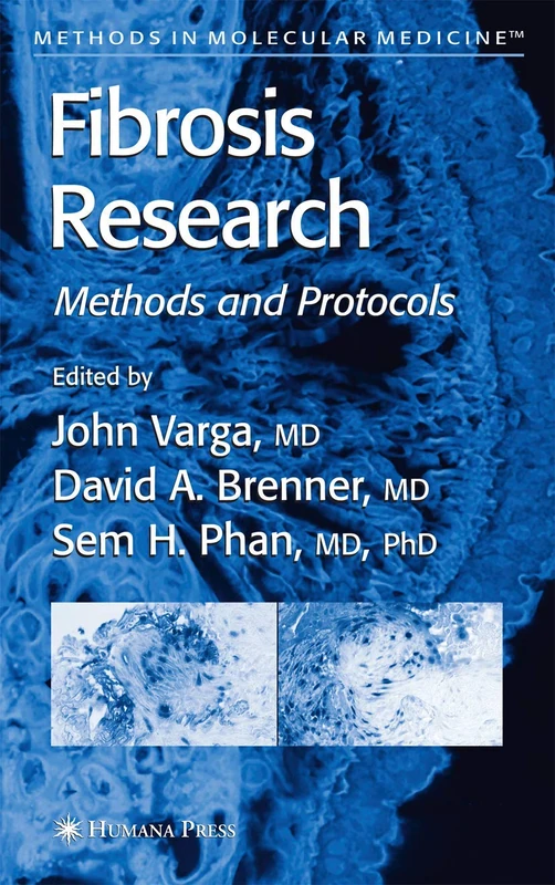 Fibrosis Research: Methods and Protocols: 117 (Methods in Molecular Medicine, 117)