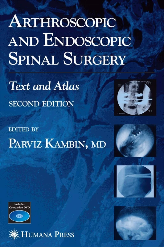 Arthroscopic and Endoscopic Spinal Surgery: Text and Atlas - Image 1