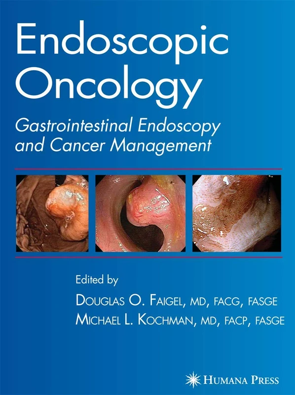 Endoscopic Oncology: Gastrointestinal Endoscopy And Cancer Management