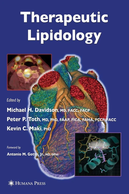 Therapeutic Lipidology (Contemporary Cardiology)