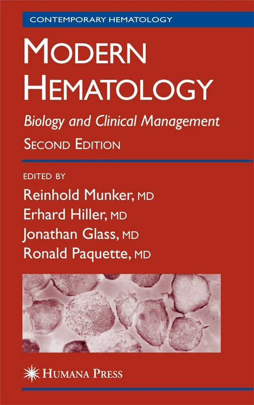 Modern Hematology: Biology and Clinical Management: 864 (Contemporary Hematology, 864)