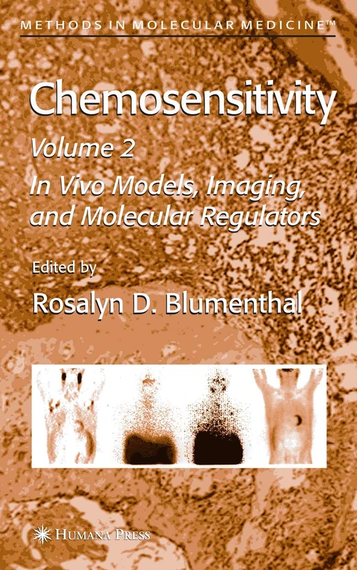 Chemosensitivity: Volume II: In Vivo Models, Imaging, and Molecular Regulators: 111 (Methods in Molecular Medicine, 111)