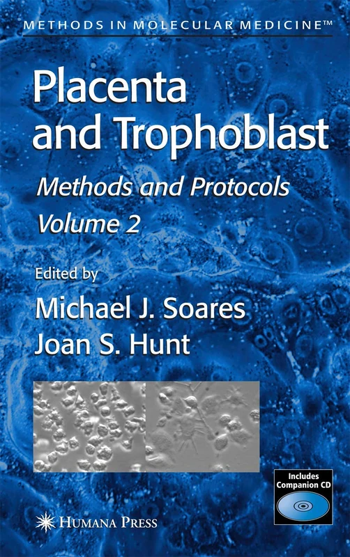 Placenta and Trophoblast: Methods and Protocols, Volume II: 122 (Methods in Molecular Medicine, 122)