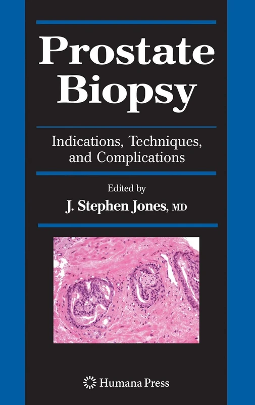 Prostate Biopsy: Indications, Techniques, and Complications (Current Clinical Urology)