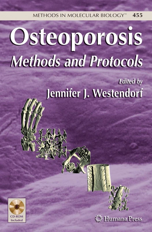 Osteoporosis: Methods and Protocols: 455 (Methods in Molecular Biology, 455)