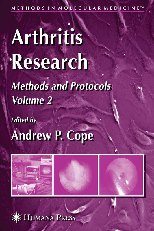 Arthritis Research: Volume 2: Methods and Protocols: 136 (Methods in Molecular Medicine, 136)