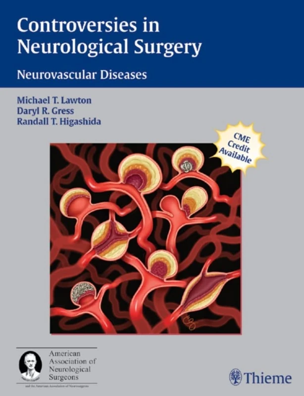 Controversies in Neurological Surgery (A Co-publication of Thieme And the American Association of Neurological Surgeons): Neurovascular Diseases