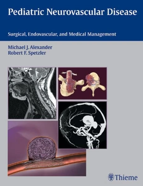 Pediatric Neurovascular Disease: Surgical, Endovascular and Medical Management