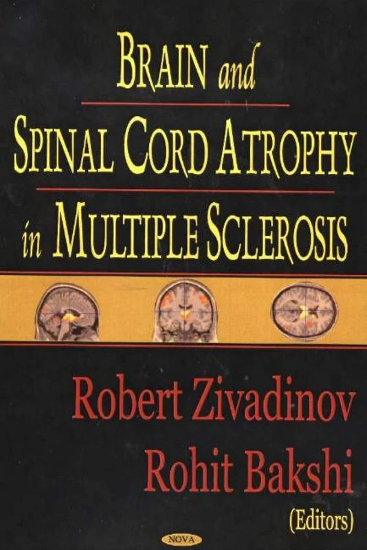 Brain and Spinal Cord Atrophy in Multiple Sclerosis