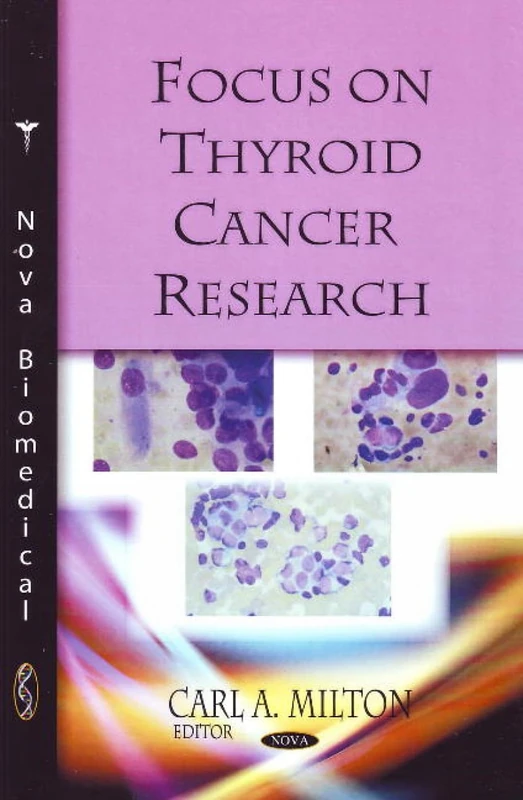 Focus on Thyroid Cancer Research - Nova Science Publishers