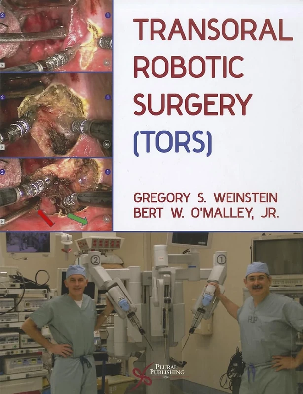 Transoral Robotic Surgery (Tors)