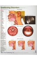 Swallowing Disorders