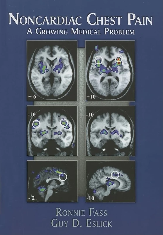Noncardiac Chest Pain (NCCP) - a Growing Medical Problem