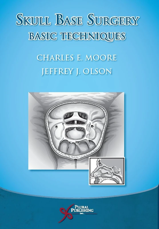 Skullbase Techniques and Concepts: Basic Techniques