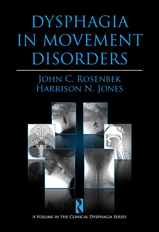 Dysphagia in Movement Disorders (Clinical Dysphagia)