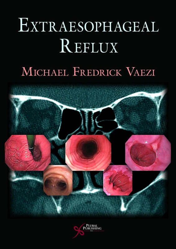 Extra Esophageal Reflux