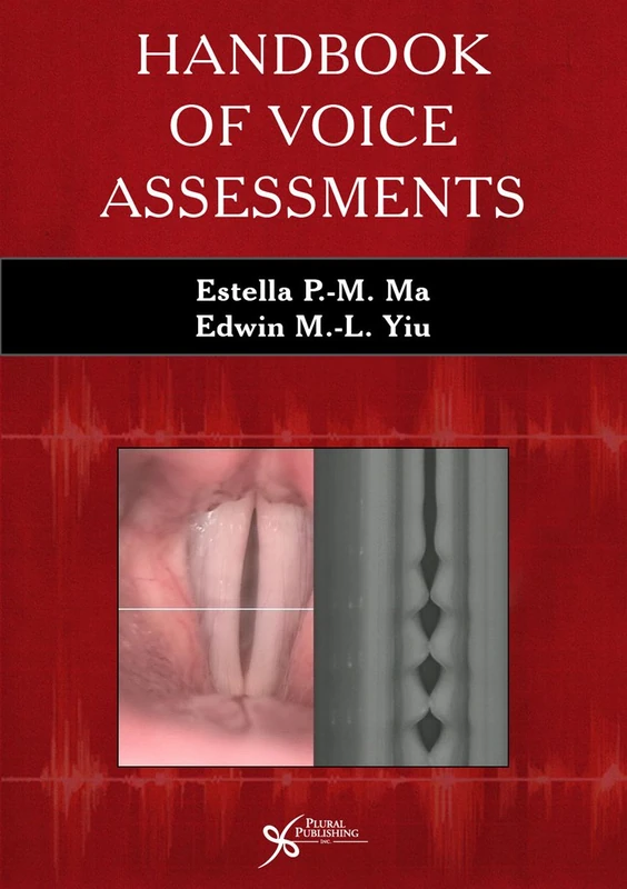 Handbook of Voice Assessments