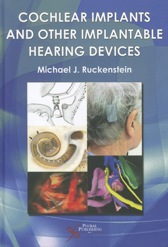 Cochlear Implants and Other Implantable Hearing Devices