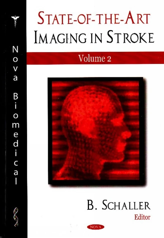State-of-the-Art Imaging in Stroke: v. 2: Volume 2