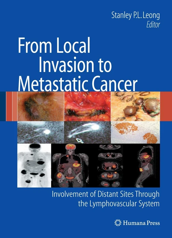 From Local Invasion to Metastatic Cancer: Involvement of Distant Sites Through the Lymphovascular System (Current Clinical Oncology)