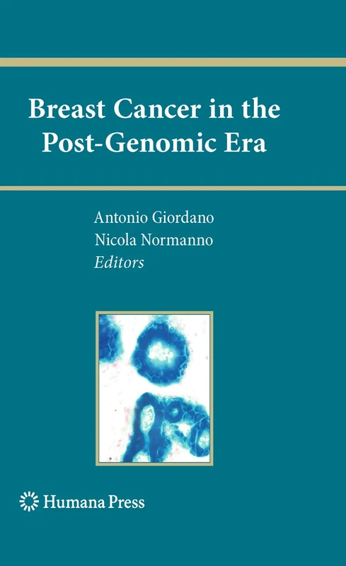 Humana Breast Cancer in the Post-Genomic Era - Oncology Book