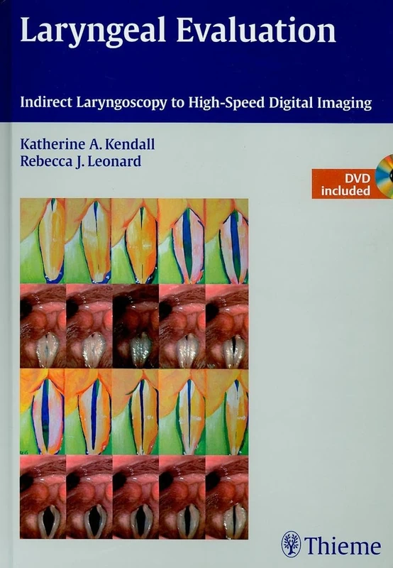 Laryngeal Evaluation: Indirect Laryngoscopy to High-Speed Digital Imaging