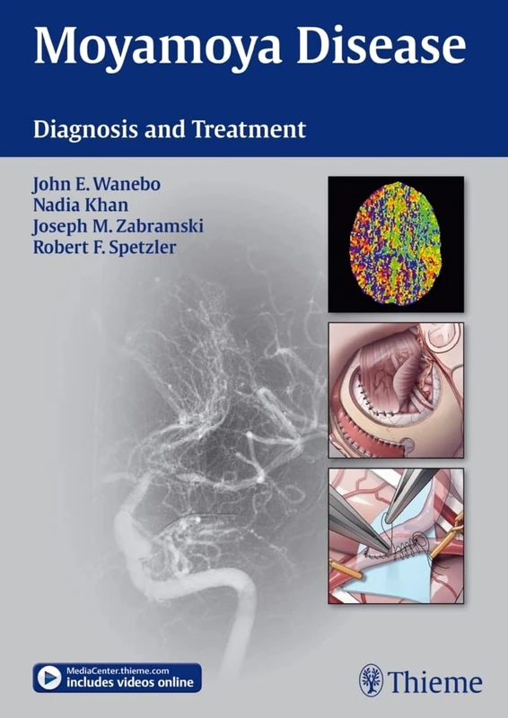 Thieme Moyamoya Disease: Diagnosis and Treatment Textbook