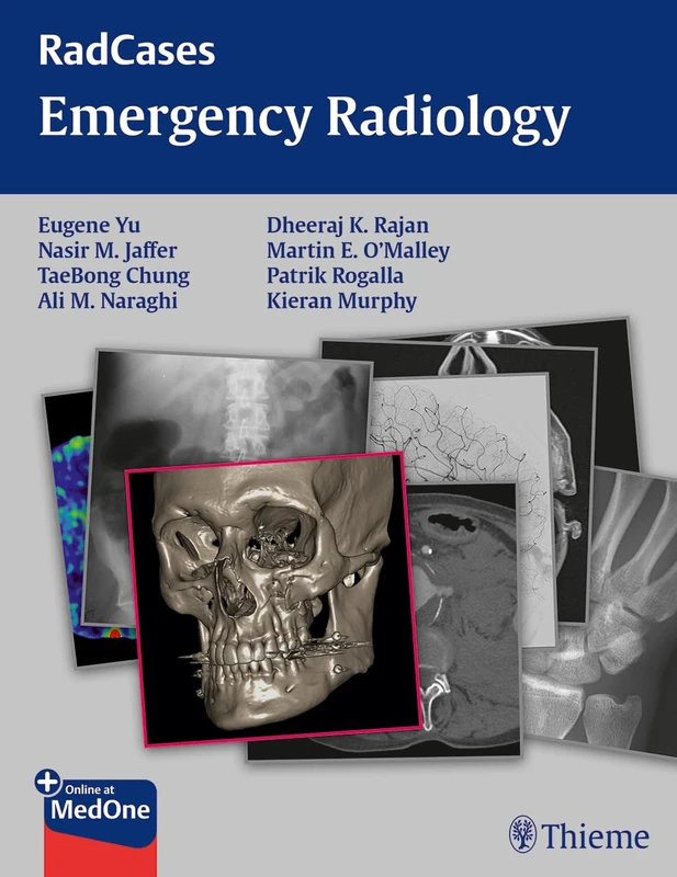 Emergency Radiology (Radcases Plus Q&a)