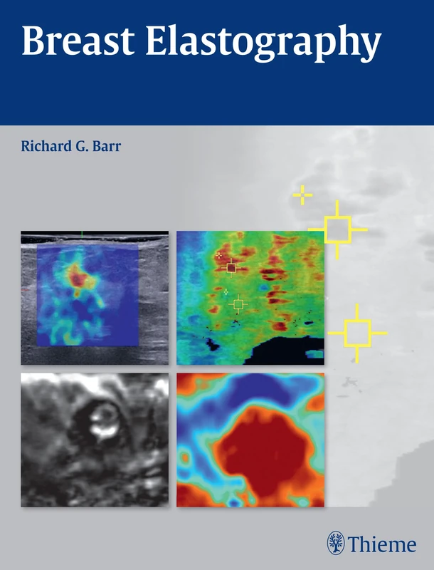 Breast Elastography - Image 1