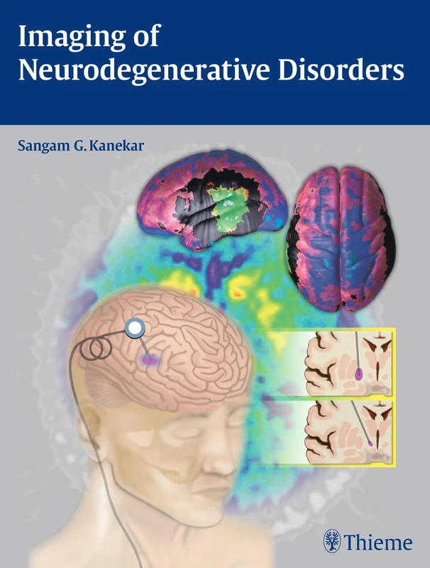 Thieme Imaging of Neurodegenerative Disorders Reference Book