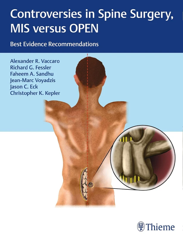 Controversies in Spine Surgery, MIS versus OPEN: Best Evidence Recommendations