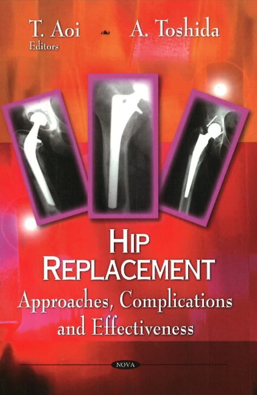 Hip Replacement: Approaches, Complications and Effectiveness