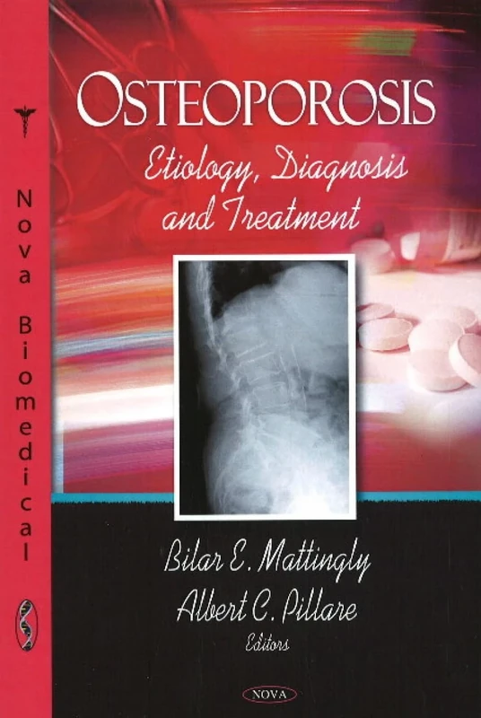 Osteoporosis: Etiology, Diagnosis and Treatment