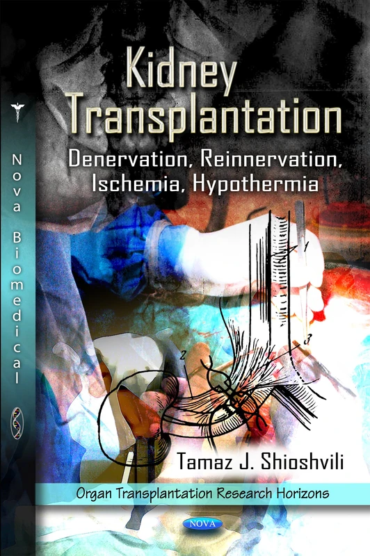 Kidney Transplantation: Denervation, Reinnervation, Ischemia, Hypothermia (Organ Transplantation Research Horizons)
