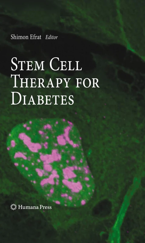Stem Cell Therapy for Diabetes (Stem Cell Biology and Regenerative Medicine)