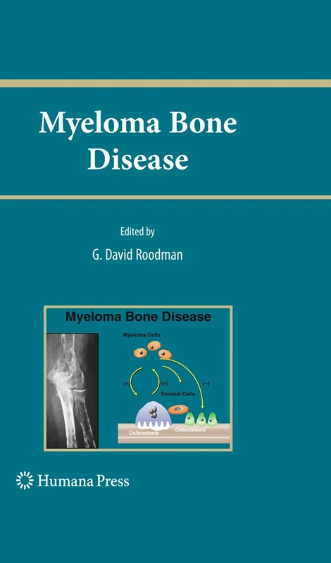Myeloma Bone Disease (Current Clinical Oncology)