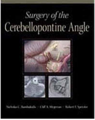 Surgery of the Cerebellopontine Angle - Image 1
