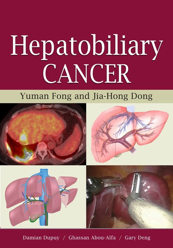 Hepatobiliary Cancer (AGENCY/DISTRIBUTED)