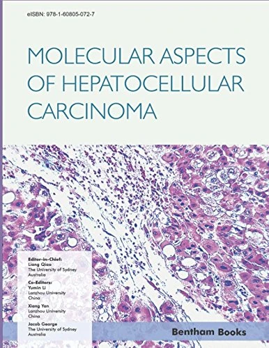 Molecular Aspects of Hepatocellular Carcinoma