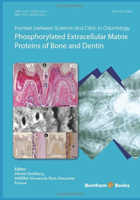 Phosphorylated Extracellular Matrix Proteins of Bone and Dentin (Frontiers between Science and Clinic in Odontology)