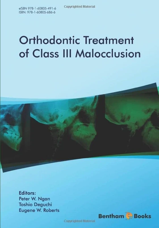Orthodontic Treatment of Class III Malocclusion