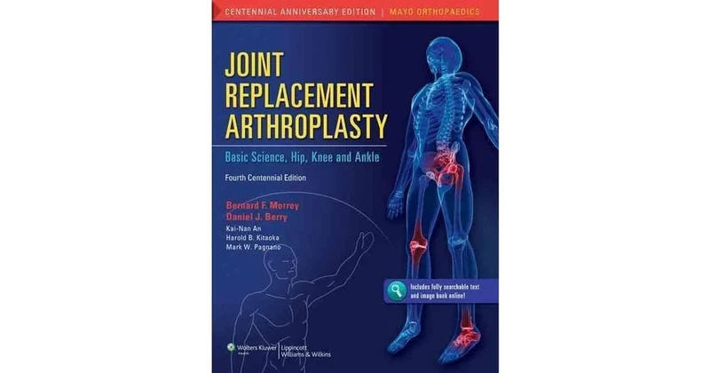 Joint Replacement Arthroplasty: Volume II: Hip, Knee, and Ankle: 2: Basic Science, Hip, Knee, and Ankle