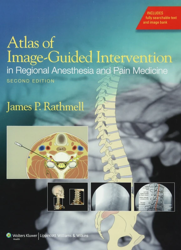 Atlas of Image-guided Intervention in Regional Anesthesia and Pain Medicine (0)